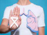 cáncer de pulmón, cáncer de pulmón en no fumadores, cáncer de pulmón de células no pequeñas