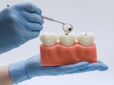 deterioro cognitivo, demencia, función cognitiva, microbioma oral, salud oral, salud bucal, salud periodontal, salud cognitiva