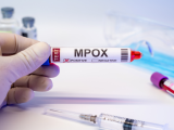 mpox, virus mpox, viruela del mono, orthopoxvirus