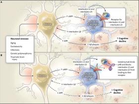 Neuroinflamación y Alzheimer