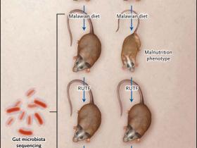 La desnutrición y el microbioma