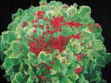 Anticuerpos monoclonales contra el VIH