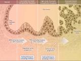 Autofagia, p53 y el cáncer de páncreas