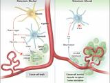 Decodificando la metástasis cancerosa