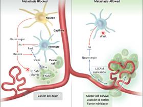Decodificando la metástasis cancerosa