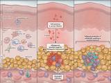 Adipocitos contra el <i>Staphylococcus aureus</i>