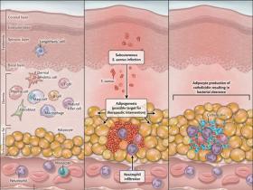 Adipocitos contra el <i>Staphylococcus aureus</i>
