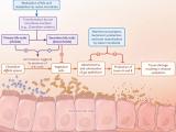 Bacterioterapia para la infección por <i>Clostridium difficile</i>