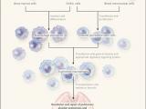 Trasplante de macrófagos para la proteinosis alveolar pulmonar