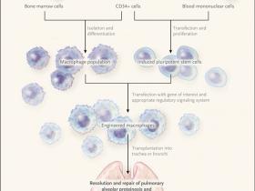 Trasplante de macrófagos para la proteinosis alveolar pulmonar