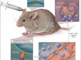 La inmunoterapia de los gliomas