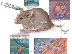 La inmunoterapia de los gliomas