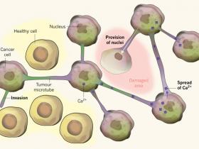Cáncer cerebral: un eficaz mecanismo de resistencia