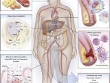 Un presentimiento visceral sobre la trombosis