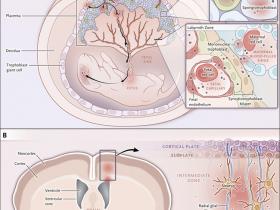 Zika virus: mecanismo para una herencia precoz