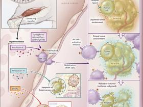 Musculatura contra el cáncer