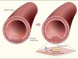 Freno mitocondrial a la reparación vascular