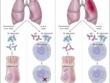 Anticuerpos: guardianes  y opresores en la tuberculosis