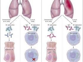 Anticuerpos: guardianes  y opresores en la tuberculosis