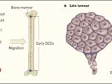 La ruta desconocida del cáncer de mama