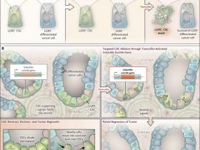 ¿Eliminar células madre cancerosas para salvar el colon?