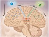 Una profunda estimulación cerebral