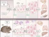 Grasa propulsora de cáncer prostático