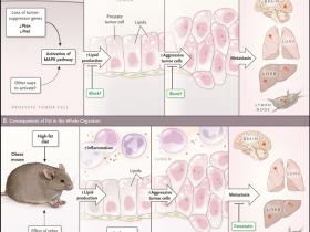 Grasa propulsora de cáncer prostático