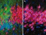 Cuestionamiento a la neurogénesis humana