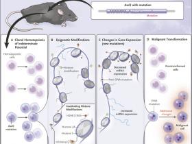 Transición maligna en la hematopoiesis