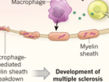 Autoproliferación inmune y esclerosis múltiple