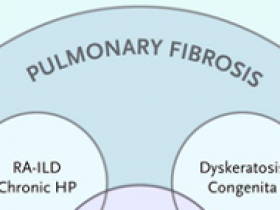 Los secretos de la fibrosis pulmonar idiopática