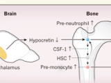 Un sueño reparador para la aterosclerosis