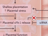 Hacia el silenciamiento de la preeclampsia