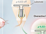 Neuromodulación eléctrica del tracto urinario