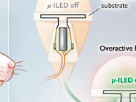 Neuromodulación eléctrica del tracto urinario