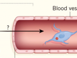 Neuroblastos: invasores en el cáncer prostático