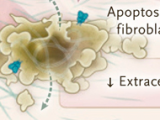 Inmunoterapia para la fibrosis cardíaca