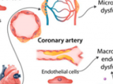 Riesgo cardiovascular en el contexto de COVID-19