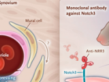 Los fibroblastos en la artritis reumatoide