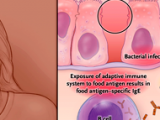 La vía alérgica en el dolor abdominal