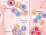 Cerrando el círculo sobre inflamación, enfermedades y cáncer