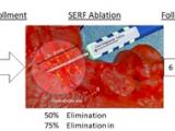 Ablación de la taquicardia ventricular refractaria 