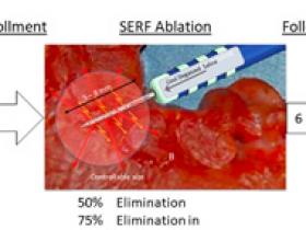 Ablación de la taquicardia ventricular refractaria 