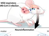 COVID-19: déficit cognitivo a largo plazo