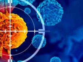 Cáncer de próstata localizado: pasado y presente