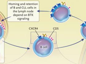 Manejo dirigido para la leucemia linfocítica crónica