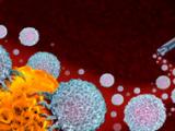 Adyuvancia y neoadyuvancia en el cáncer de pulmón