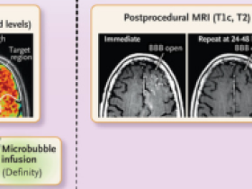 Un nuevo camino para la administración de fármacos al cerebro