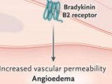 Hacia el control total del angioedema hereditario